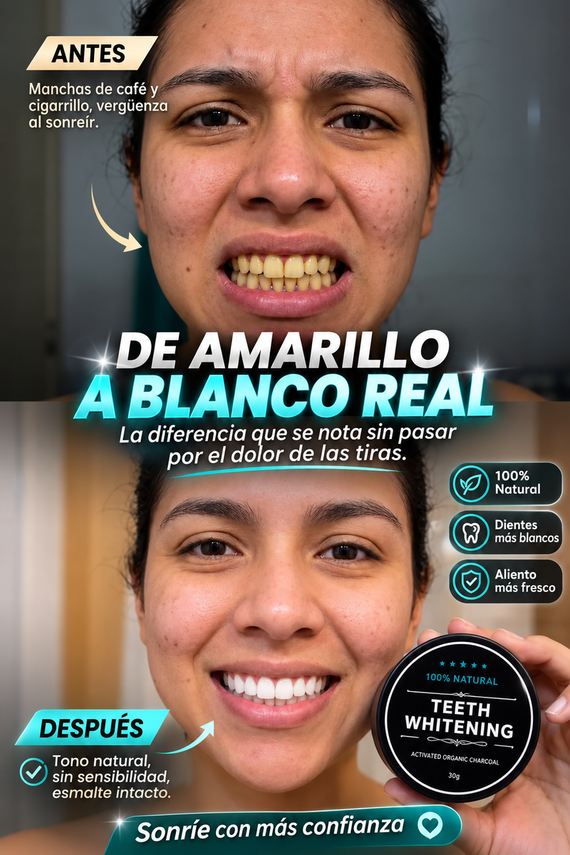Antes y despues de usar el blanqueador dental
